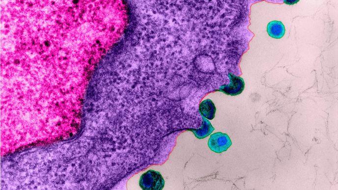 Virus HIV v těle hostitele