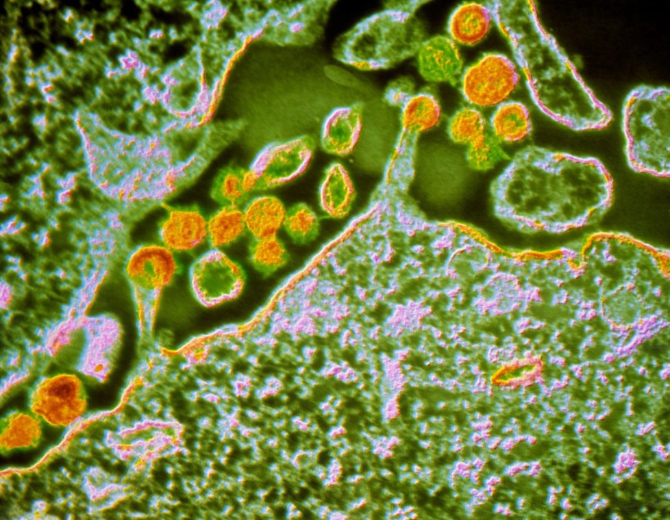 Virus HIV v těle hostitele