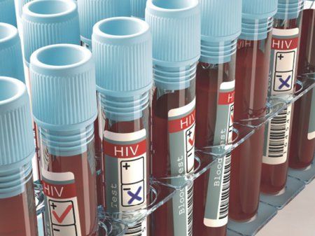 Test na HIV má smysl až zhruba tři měsíce po rizikové aktivitě.