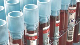 Test na HIV má smysl až zhruba tři měsíce po rizikové aktivitě.