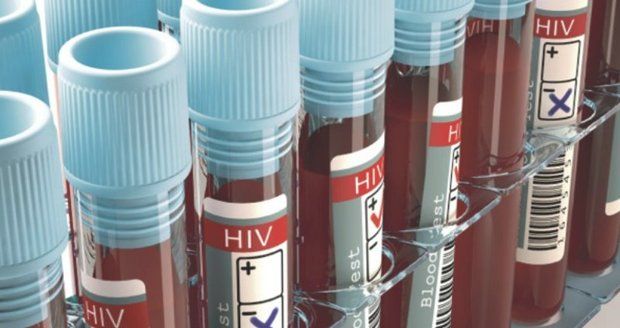 Hrozba HIV s koronavirem nepominula, varují experti. Česko si připomene oběti AIDS