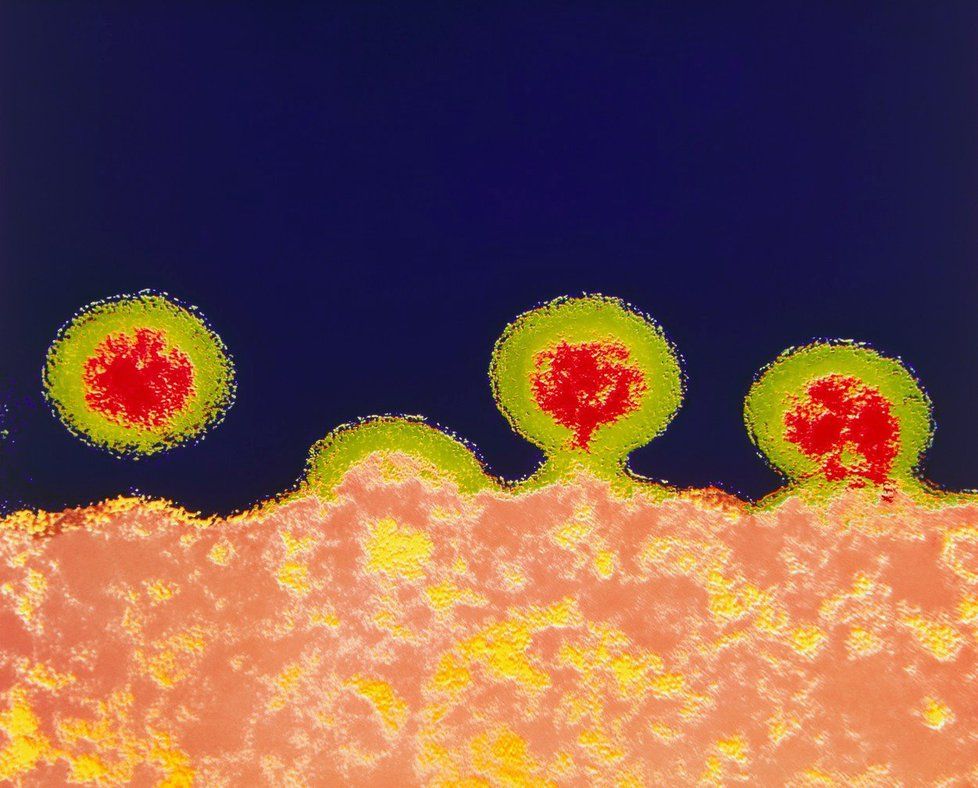 Virus HIV.