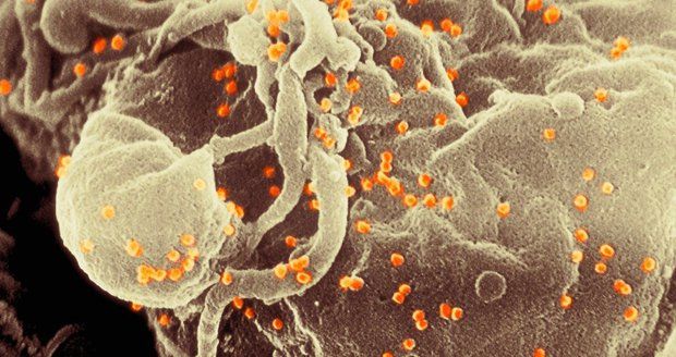 Naděje pro 37 milionů pacientů: Lékaři zřejmě vyléčili muže s HIV