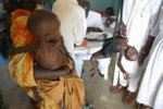 Na Madagaskaru zemřelo hlady už 16 dětí!