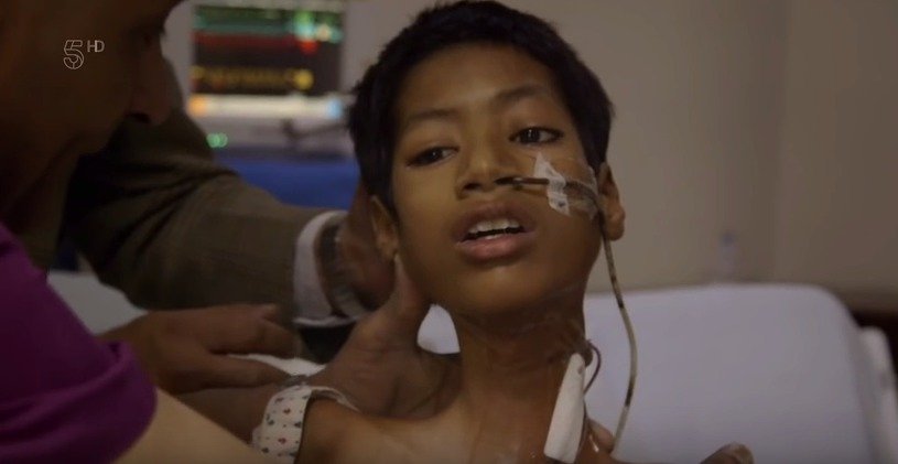 Mahendra podstoupil operaci, která mu krk narovnala.