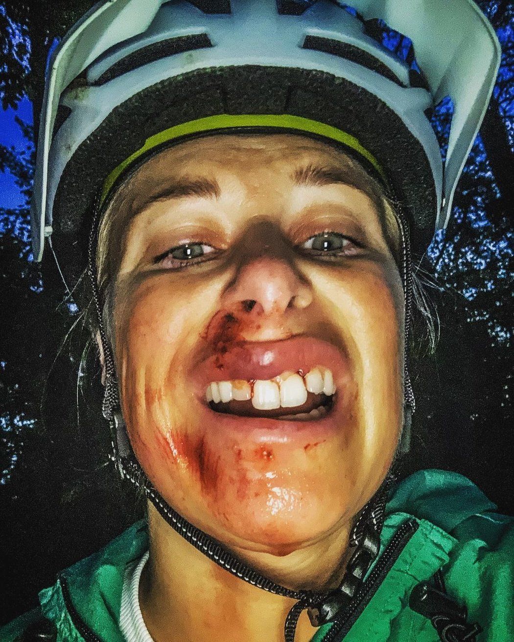 Takhle dopadla Andrea Sestini Hlaváčková po vyjížďce na kole.