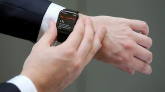 Vyhodnocení EKG online nabízí první česká pojišťovna, zatím jen u hodinek Apple
