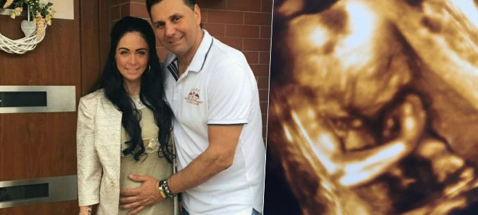 Těhotná přítelkyně kouče Vladimíra Růžičky ukázala miminko! Marii roste v bříšku holčička.