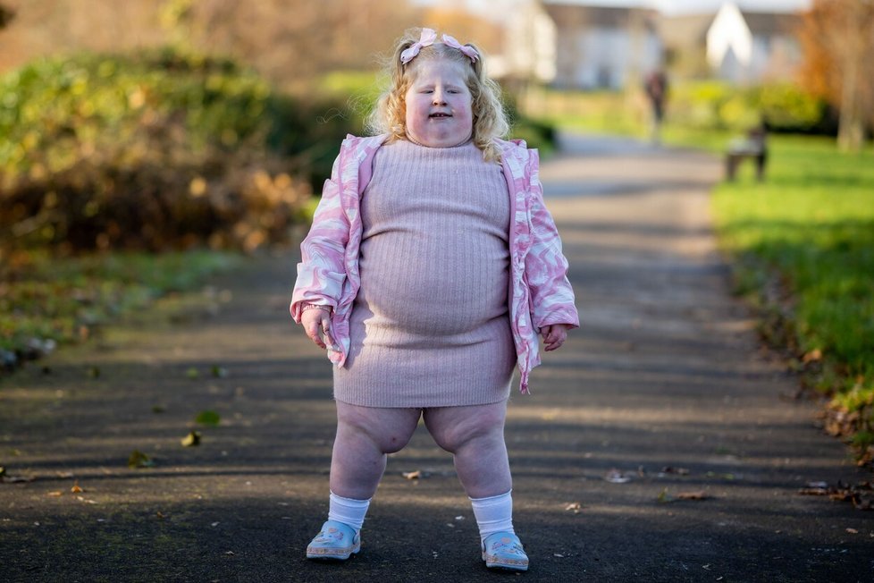 Pětiletá Harlow trpí vzácným genetickým onemocněním, které způsobuje, že má neustálý pocit hladu.