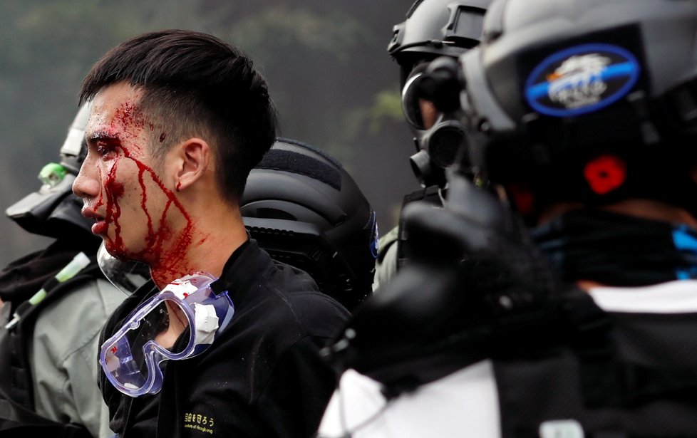 Policie tvrdě zasáhla proti demonstrantům v areálu univerzity.