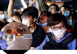 Koronavirus řeší i v Hongkongu. (ilustrační foto)