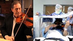 Místo spánku si při operaci mozku hrál na housle, každý zvládá stres jinak!