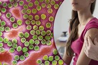 Hrozí další epidemie? Zákeřný vir děsí odborníky více než HIV: Očkování děti ochrání