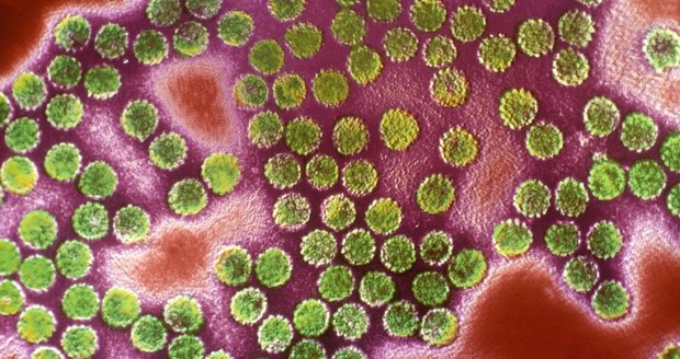 HPV virus: Víte, co způsobuje?