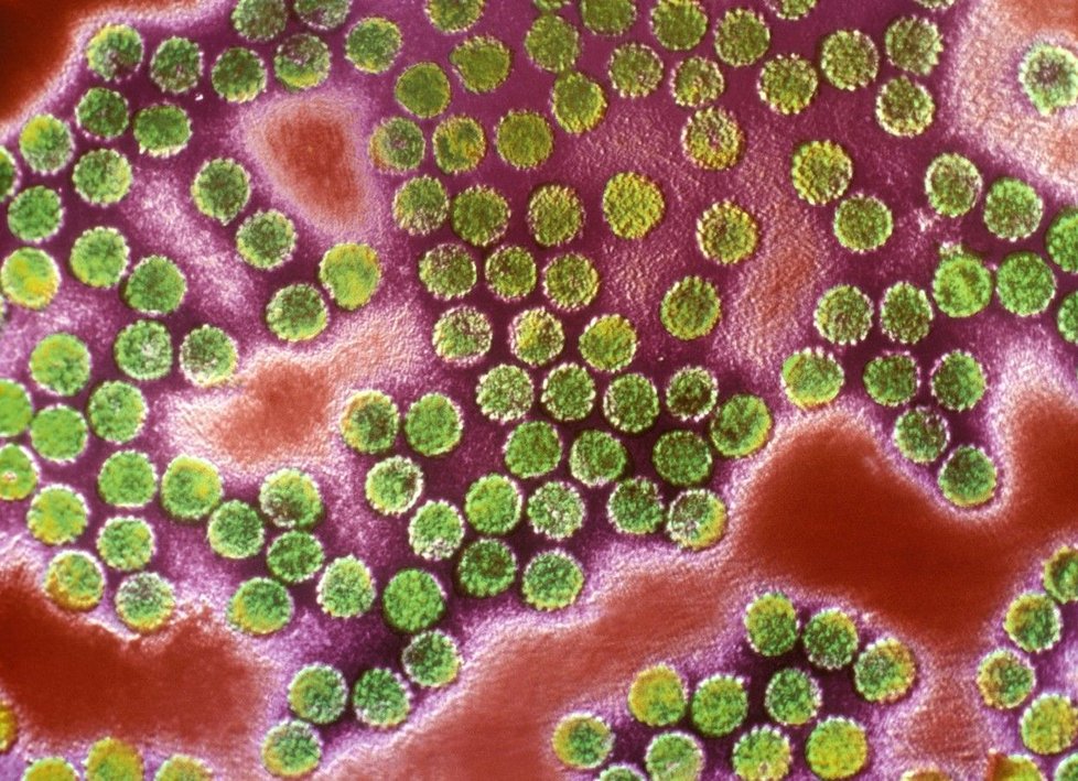 HPV virus: Víte, co způsobuje?