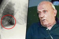 Američan Ron Sveden: V plicích mu vyklíčil hrášek