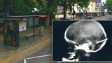 Brutální napadení na křižovatce v Kolíně nad Rýnem: Zatloukl dívce  hřebík do hlavy!