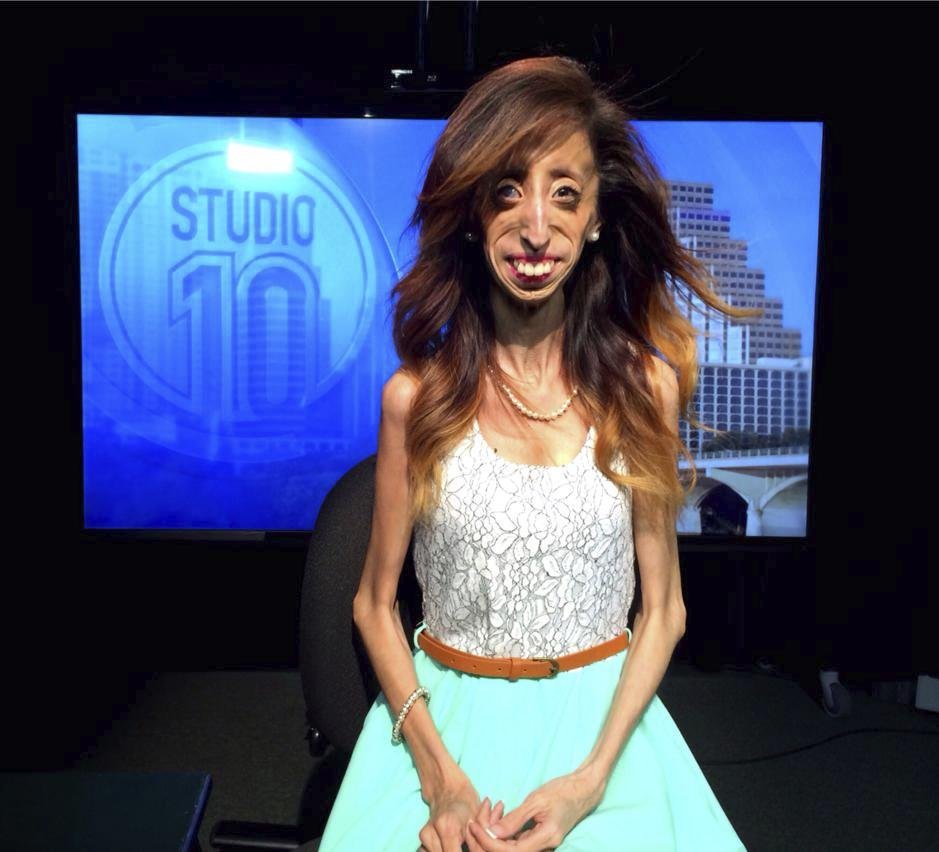 Lizzie Velasquezová je nejhubenější ženou.