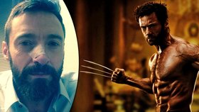 Hvězda X-Men Hugh Jackman: Vrátila se mi rakovina!