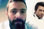 Herec Hugh Jackman porazil potřetí rakovinu, ta si na něj "políčila" během roku už podruhé...