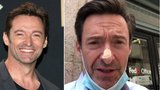 Hollywoodský krasavec Hugh Jackman opět bojuje s rakovinou kůže? Můžu si za to sám! říká