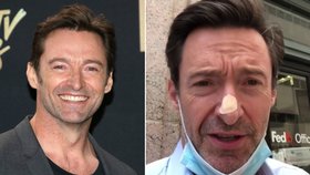 Hollywoodský krasavec Hugh Jackman opět bojuje s rakovinou kůže? Můžu si za to sám! říká 