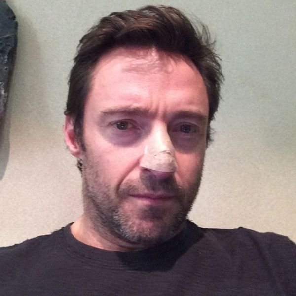 Hugh Jackman ukázal fotku po operaci