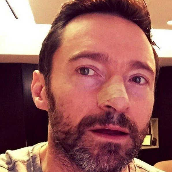 Hugh Jackman nyní