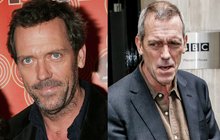 Dr. House alias Hugh Laurie vypadá příšerně! Bez vlasů, strhaný... NEMOC?!