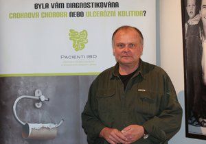 Herec Igor Bareš podporuje výzkum Crohnovy choroby, kterou trpí.