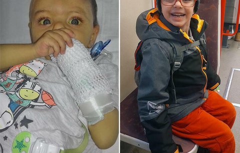 Malý statečný bojovník! Honzík jako miminko prodělal transplantaci jater, dnes už se těší do školy