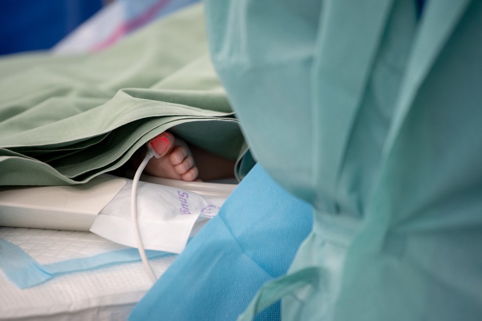 V IKEM odstranili v květnu nádor jater devítiměsíčnímu chlapci dvěma unikátními operacemi. Hoch podle lékařů podstoupil zákrok jako nejmladší na světě.