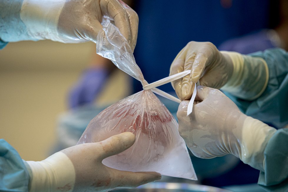 Lékaři v pražském Institut klinické a experimentální medicíny (IKEM) v roce 2021 transplantovali rekordních 542 orgánů. (7. ledna 2022)