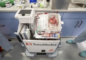 Pražský IKEM poprvé použil metodu převozu bijícího srdce k transplantaci pro převoz orgánu ze Slovenska do ČR, kde se díky tomu podařilo zachránit život pětileté holčičce. (2. února 2022)