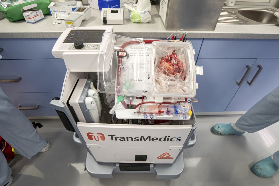 Pražský IKEM poprvé použil metodu převozu bijícího srdce k transplantaci pro převoz orgánu ze Slovenska do ČR, kde se díky tomu podařilo zachránit život pětileté holčičce. (2. února 2022)