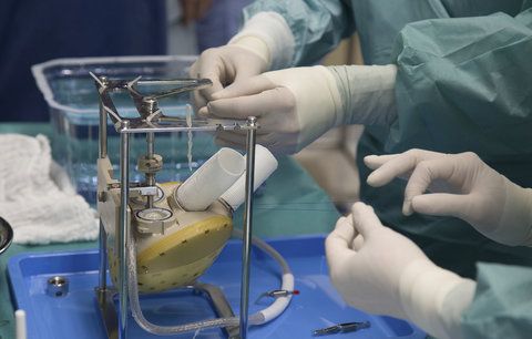 Čeští lékaři dokážou zázraky: V Ikemu voperovali pacientovi umělé srdce