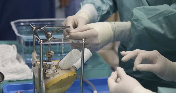 Čeští lékaři dokážou zázraky: V Ikemu voperovali pacientovi umělé srdce