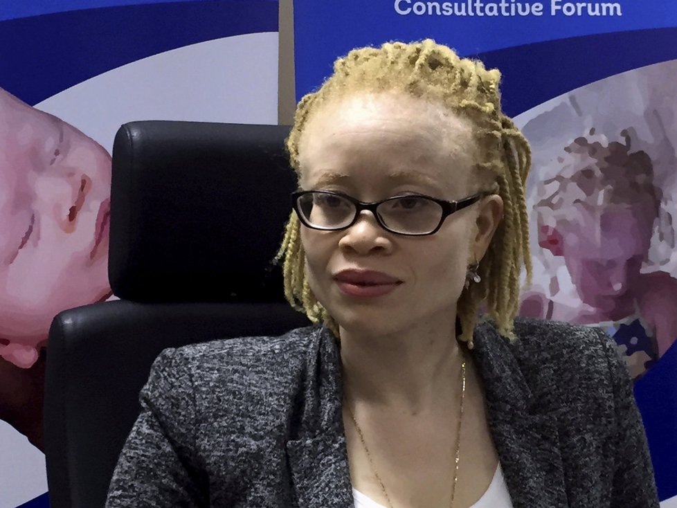 Nezávislá expertka OSN na albinismus Ikponwosa Ero