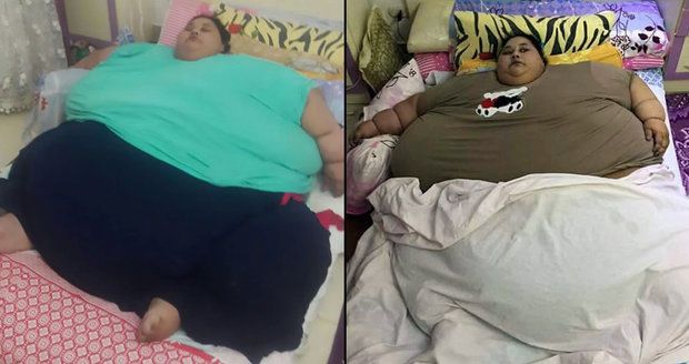 Nejtěžší ženu světa (500 kg) čeká operace: Z domu se dostane po 25 letech