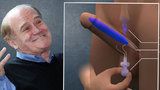V 72 letech mám erekci díky implantátu a užívám si jako Berlusconi, pochvaluje si pacient, kterého operovali v Česku