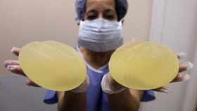 Žena chytila infekci salmonely kolem prsního implantátu (ilustrační foto)