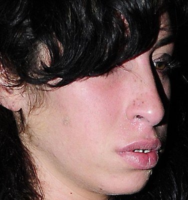 Amy winehouse s podivným práškem u nosu.