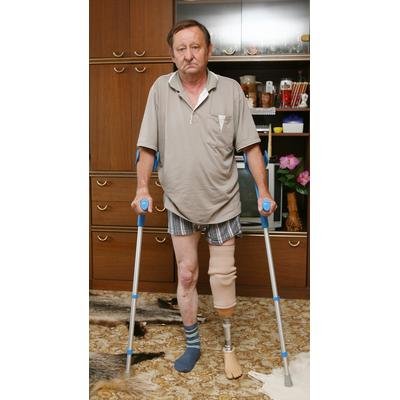 Ani bez jedné nohy neměl Otakar Svoboda nárok na plný invalidní důchod.