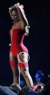 Beyoncé bojuje s celulitidou na stehnech.