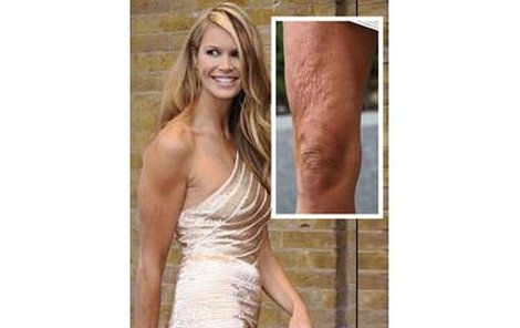 Elle MacPherson a její nohy.