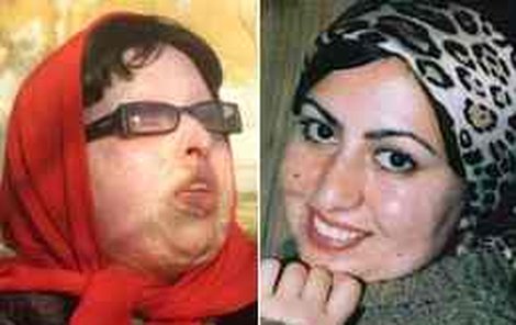 Íránce Amáni Bahrámí (31) chrstl bývalý spolužák Madžid Movahedí do obličeje kyselinu a dívka má dnes zohavenou tvář a je téměř slepá.