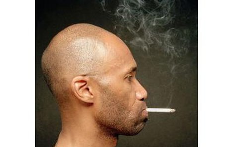 Kouření může způsobit vypadávání vlasů. Alespoň se to domnívají vědci z Tchajwanu, kteří přišli na to, že kouření poškozuje vlasové buňky.