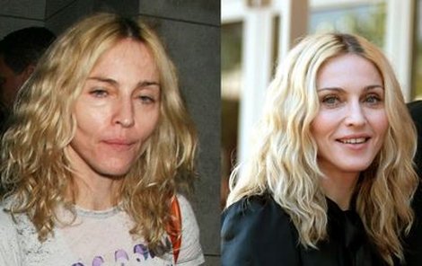 Madonna v červenci 2008 a dnes