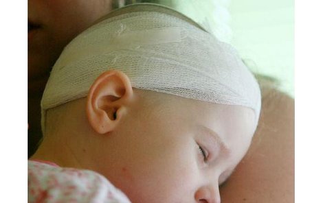 Markétka třetí den po operaci téměř celý prospala v náručí své maminky.