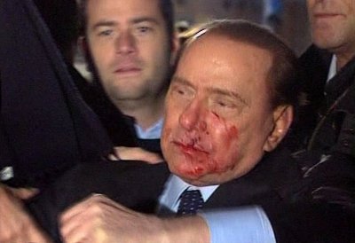 Po útoku měl Berlusconi zlomený nos, dva zlomené zuby a roztržený ret.